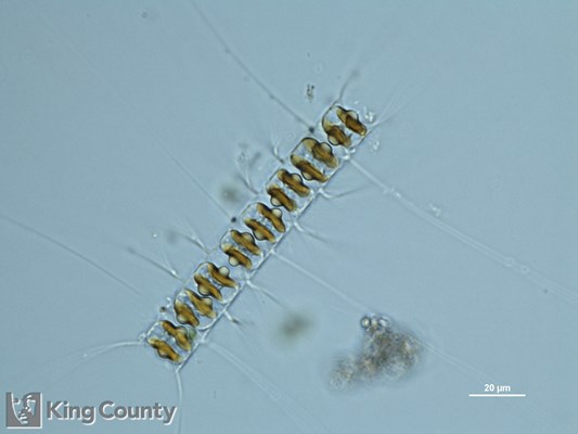 Photo of Chaetoceros didymus